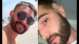 Tom Parker receives 'revolutionary treatment' in Spain amid incurable brain tumour battle