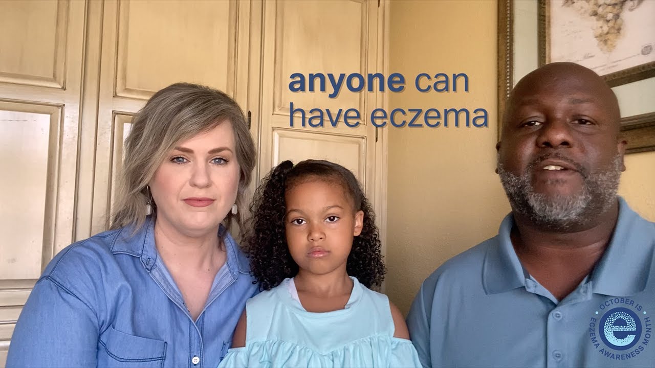 #GetEczemaWise – Eczema Facts