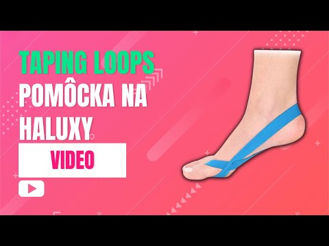 Pomôcka na haluxy Taping Loops | VIDEO | iNohy.sk