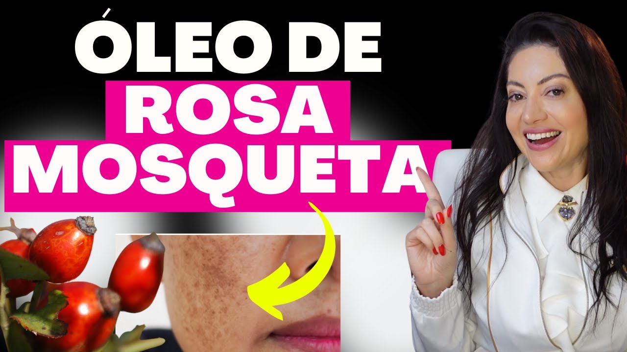 ROSEHIP OIL lightens SPOTS and MELASMA? The Revealed Truth | Dr. Greice Moraes