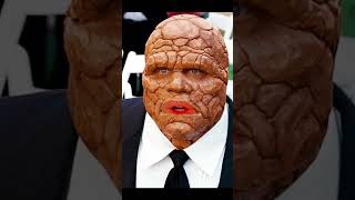 Everyone deserves love..