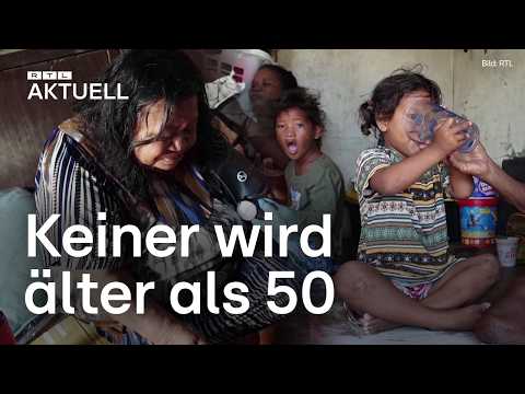 Terminally ill in paradise – The diabetes island of Ebeye | RTL Aktuell