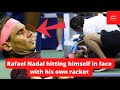 Rafael Nadal overcomes hitting himself in face with own racket. BBS NEWS