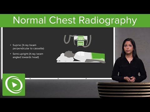 Normal Chest Radiography – Radiology | Lecturio