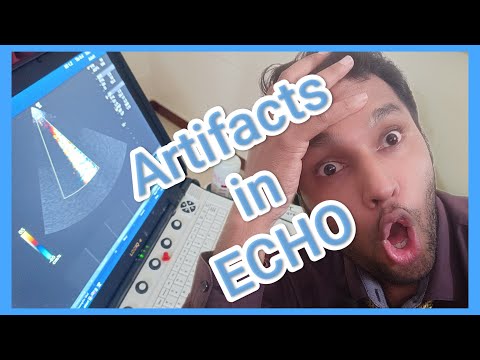 Why there is Distortion Vibration in ECHO Ultrasound | Biomedical Engineer Troubleshooting