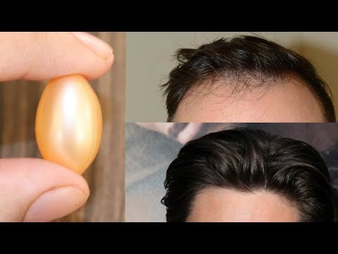 Vitamin E Capsule