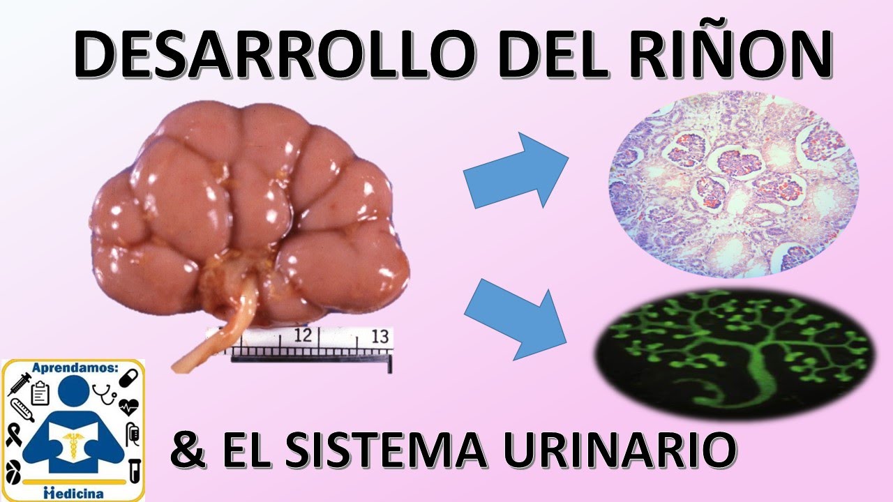 Embriologia:  Desarrollo del Sistema Urinario/Renal