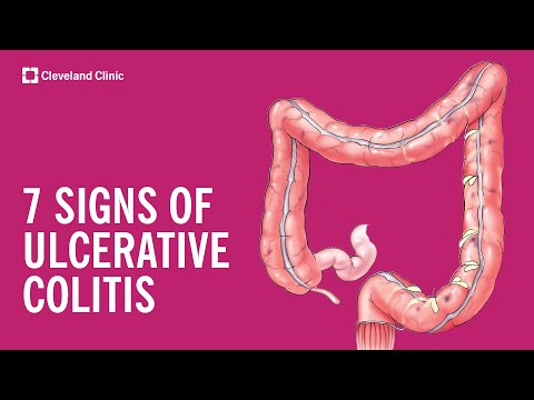 7 Warning Signs of Ulcerative Colitis