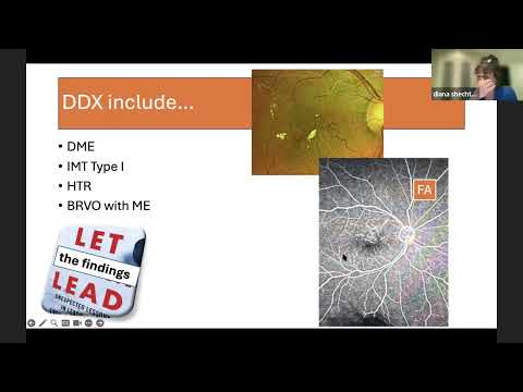 Learning the Basics from the Retinal Cases