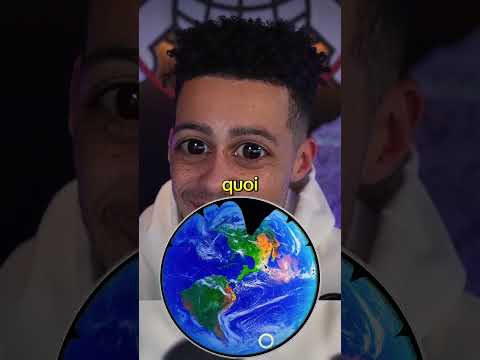 Mastu nous raconte une de ses anecdote chez le médecin 🩺 partie final #pourtoi #mastu #youtubeshorts