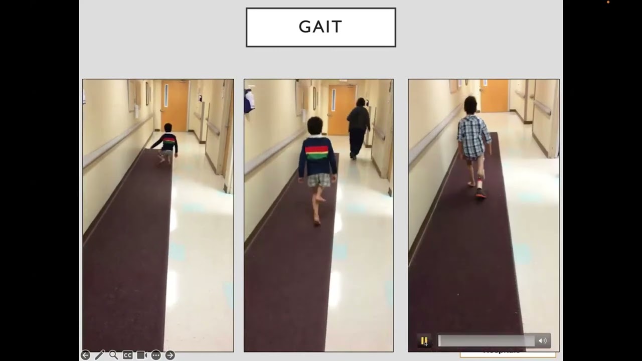 00: Session 1 Panel Discussion: Lower Limb Optimization