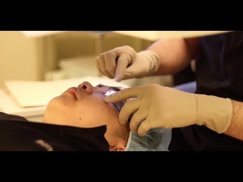 AQUA I LASER TESTIMONIAL + SURGERY VIDEO!