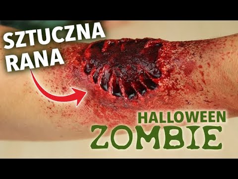 Powstrzymać rosnącej kości, które wykonują Palucha koślawego ICD kod 10