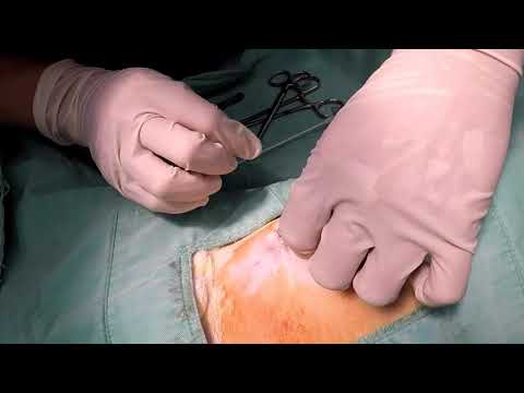 動物用胸腔引流導管