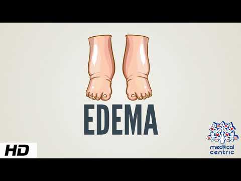 image-What are the causes of cerebral edema?