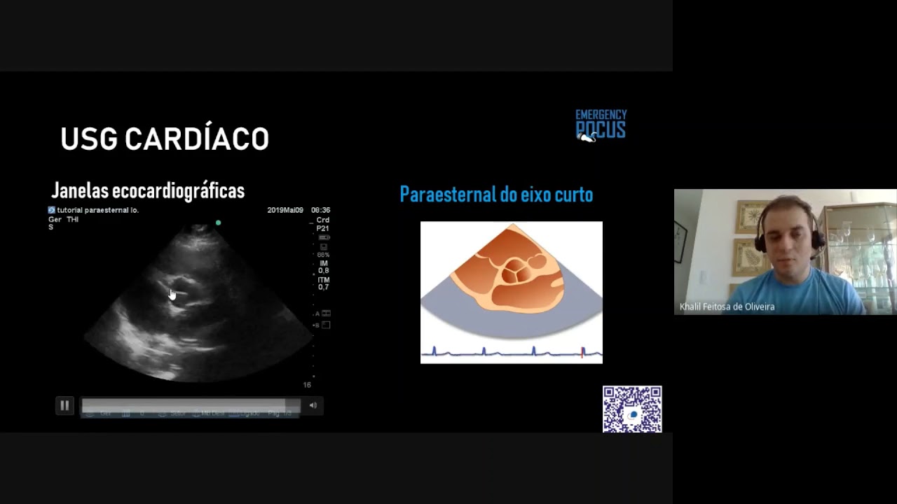 Emergency POCUS - aula USG cardíaco
