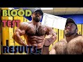 Showing My Blood Test results getting off Steroids / Testosterone after 12 years