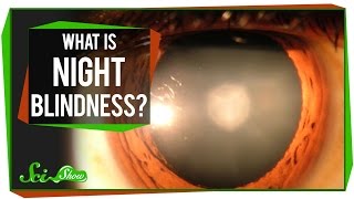 What Is Night Blindness?