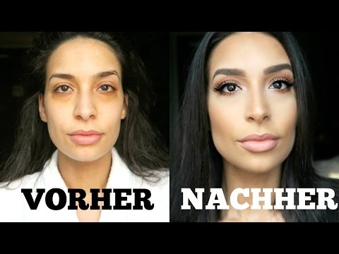 Die Tabelle nach der Schuppenflechte Die Lampen ufo für die Behandlung der Schuppenflechte