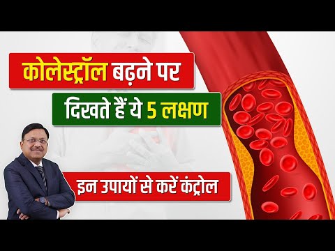 कोलेस्ट्रॉल बढ़ने पर दिखते हैं ये 5 लक्षण, इन उपायों से करें कंट्रोल | High Cholesterol Symptoms