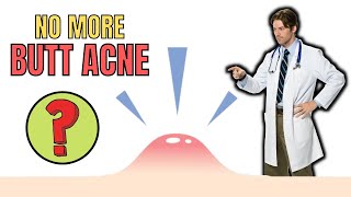 How To Get Rid Of Butt Acne Naturally | FAST AND QUICK