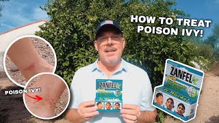 How to Treat a Poison Ivy Rash Quickly and Easily!