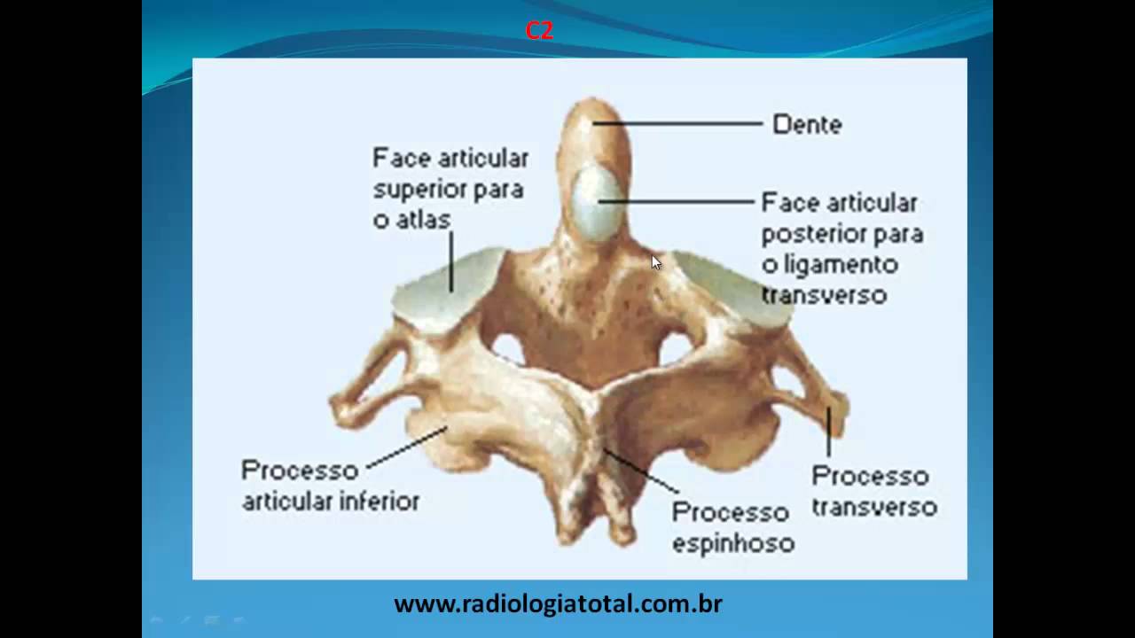 Anatomia Radiológica Coluna Vertebral parte 1