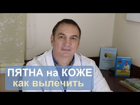 Маски для лица отбеливающие на основе лимона Ромашка и веснушка