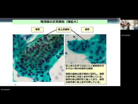 「がんと正常を細胞診で見抜く」　検査技術科学専攻　教授　齊尾征直