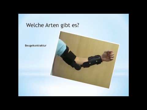 Gel von Rückenschmerzen Hernie Ziehen nach 16 Wochen Schmerzen während der Schwangerschaft zurück