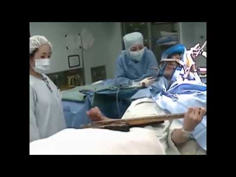 Video 119 7 Task specific Dystonia of the Right Hand in a Professional Guitarist