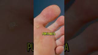 Download lagu MENGALAMI MATA IKAN? BERIKUT CARA MENGATASINYA!✨ mp3 Download lagu MENGALAMI MATA IKAN? BERIKUT CARA MENGATASINYA!✨ mp3