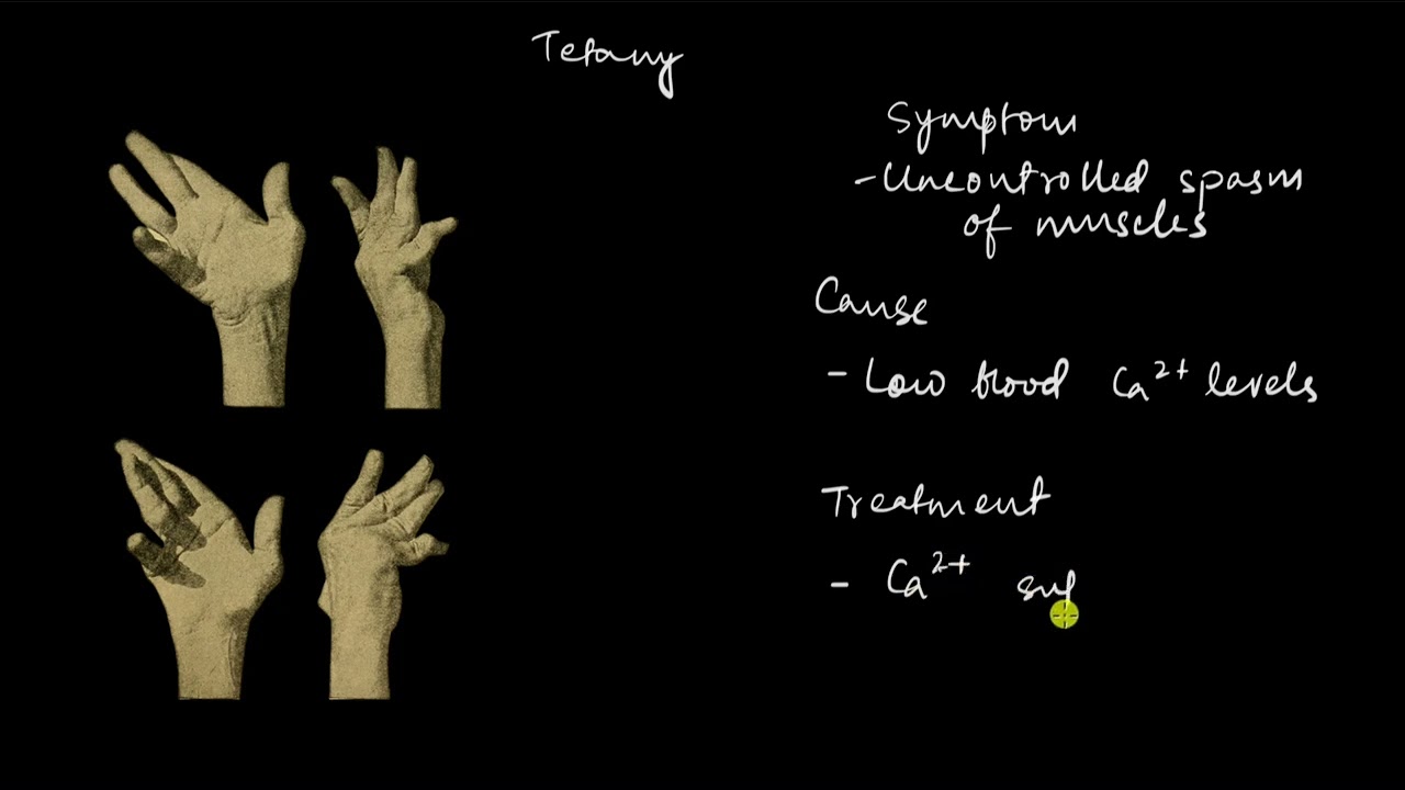 Musculoskeletal system disorders | Locomotion and movement | Biology | Khan Academy