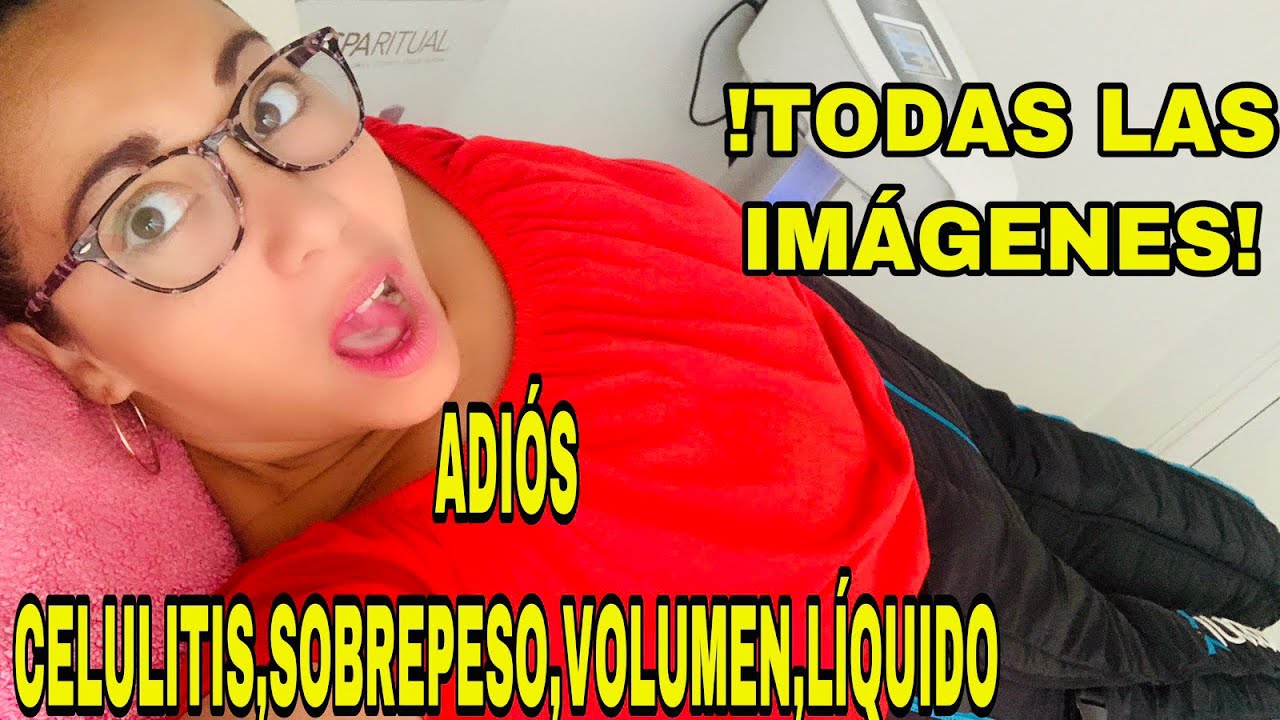 PRESOTERAPIA FUNCIONA ADIOS SOBREPESO, CELULITIS, VOLUMEN,