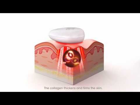 Quasar Pure Rayz – How it works