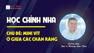 Học chỉnh nha - Mini vít ở giữa các chân răng. Giảng dạy Dr Thái với 26 năm kinh nghiệm chỉnh nha