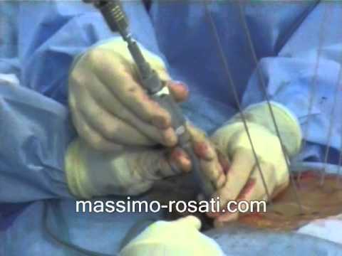 Articolazioni doloranti Trichomonas X-ray di osteocondrosi
