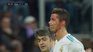 Cristiano Ronaldo INJURY Bleeding Goal - Real Madr
