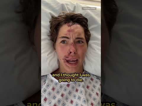 TikToker Caleb Coffee falls off cliff