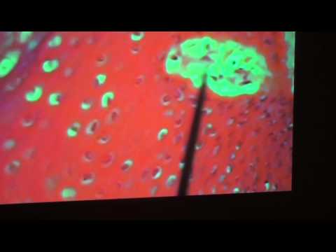 Slide of Meissner Corpuscle