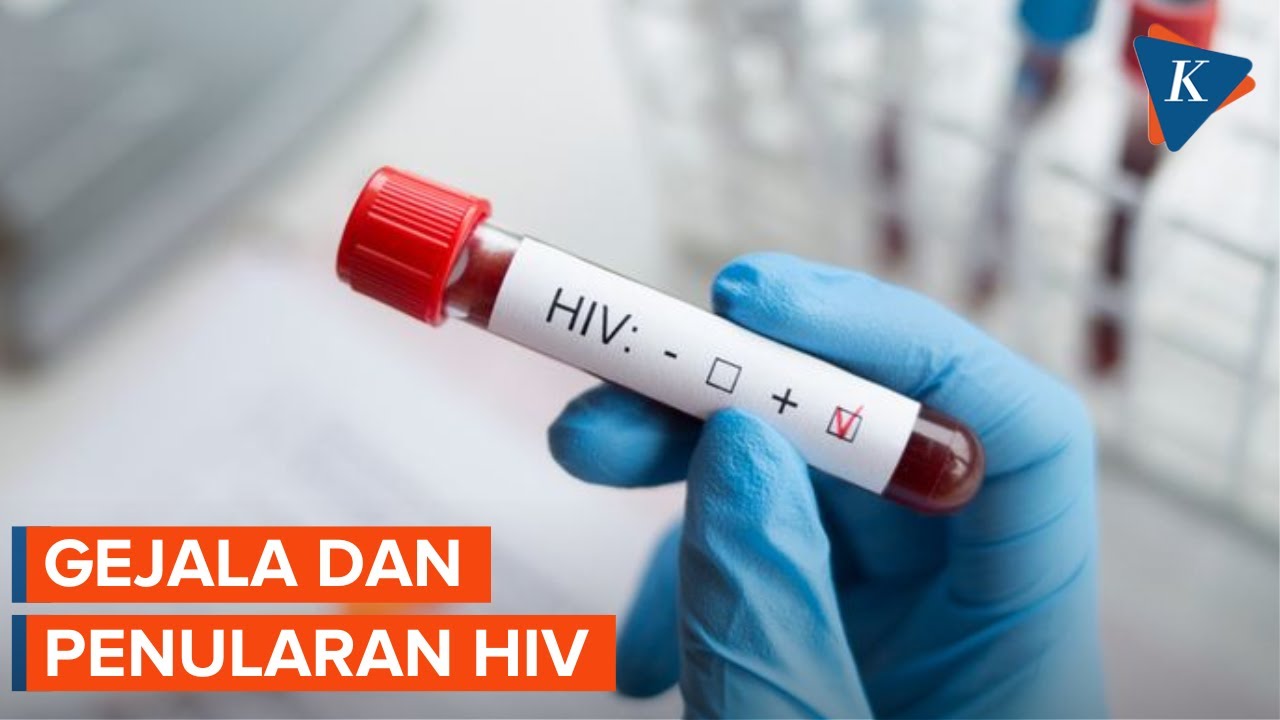 Ratusan Mahasiswa Bandung Idap HIV, Ini Gejala dan Penularannya