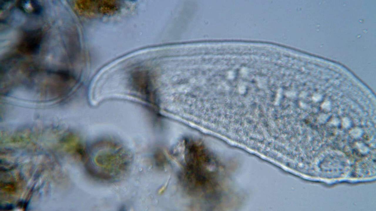 <em>Loxophyllum meleagris</em> (Mueller, 1773) Dujardin, 1841