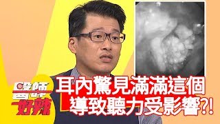 耳內驚見滿滿「這個」，導致聽力受影響？！【醫師好辣】20191030 part3 EP836 江坤俊 陳保仁