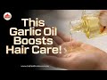 This Garlic Oil Boosts Hair Care Dabur Vatika Garlic Hair Oil For Strong Hair