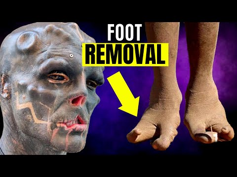 Black Alien Project Disturbing Foot Modification (This Will Ruin His Life!)