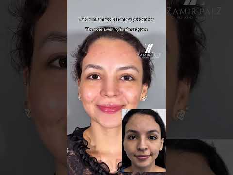 Zamir Páez-230