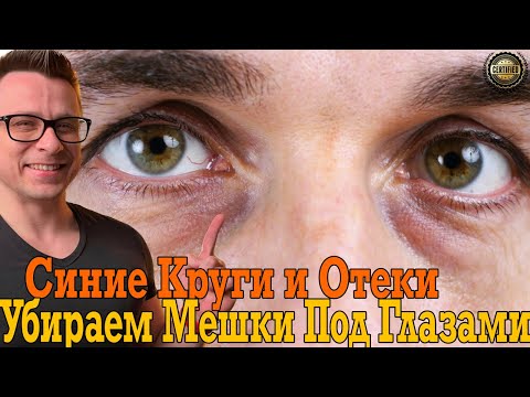Убираем синие круги, мешки и отёки под глазами и на лице!