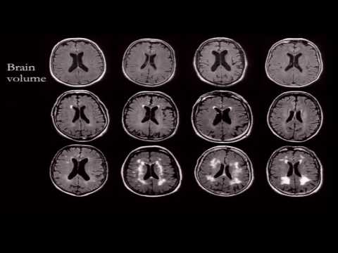 Cognitive Aging Summit III | Dr. Stuart Ritchie | Predictors and Mechanisms of Cognitive Ageing..