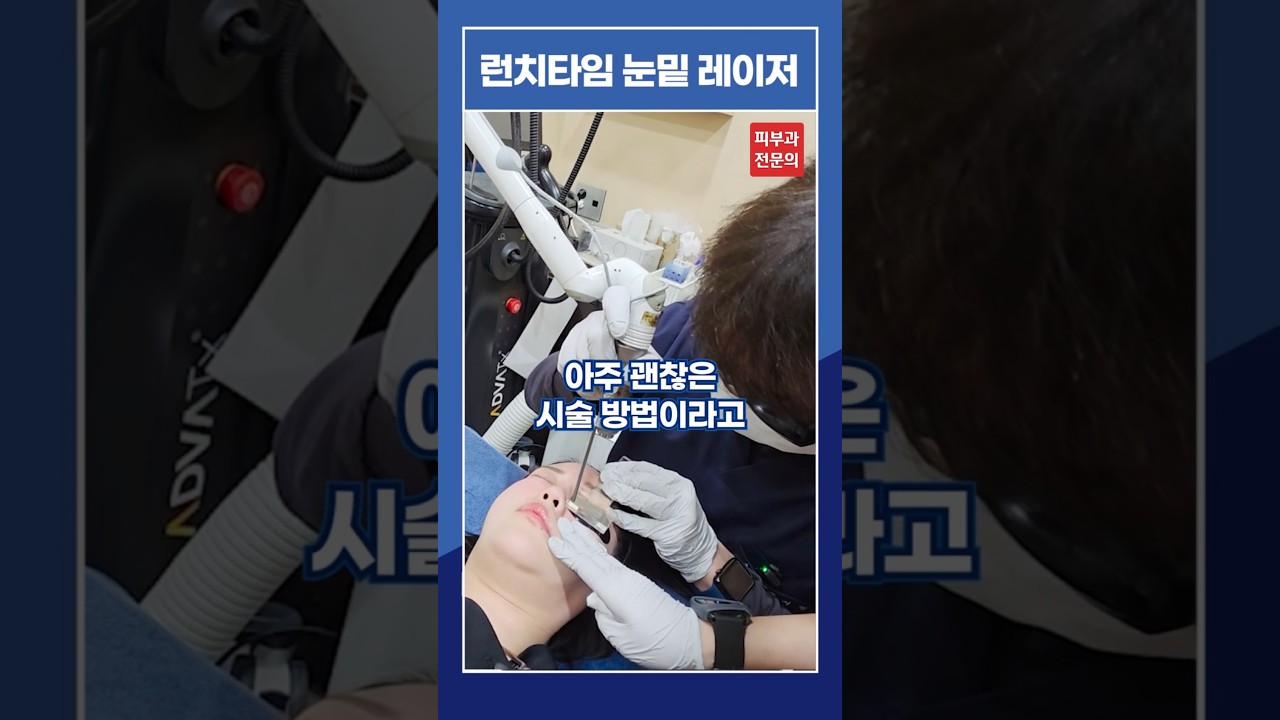 두툼했던 눈밑지방 수술 말고 레이저로 간편하게!