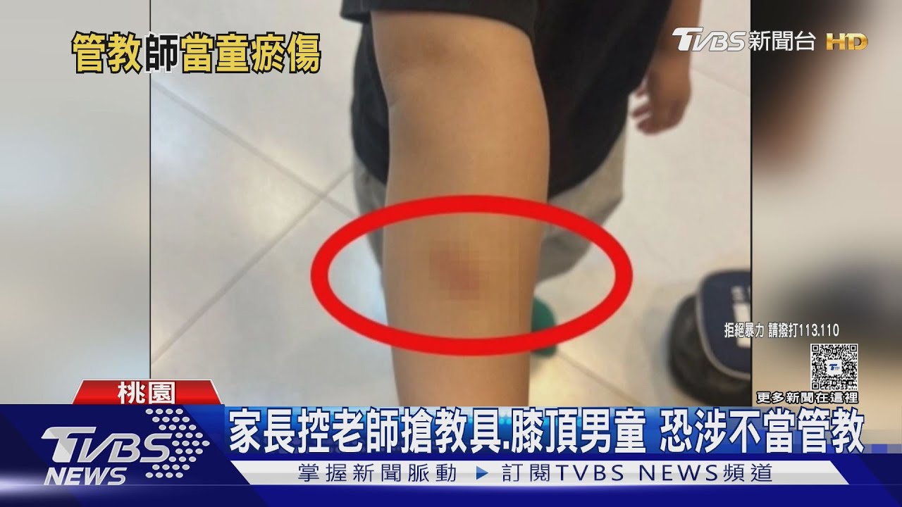 家長控老師搶教具膝頂男童　恐涉不當管教